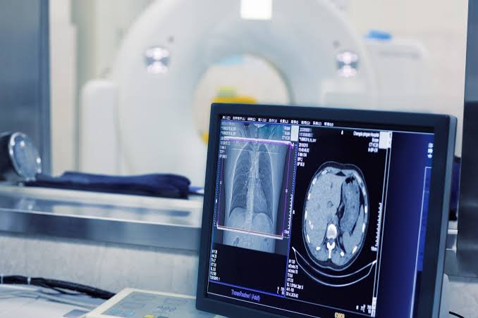 MRI exams